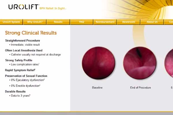 prelim-interact-with-nice